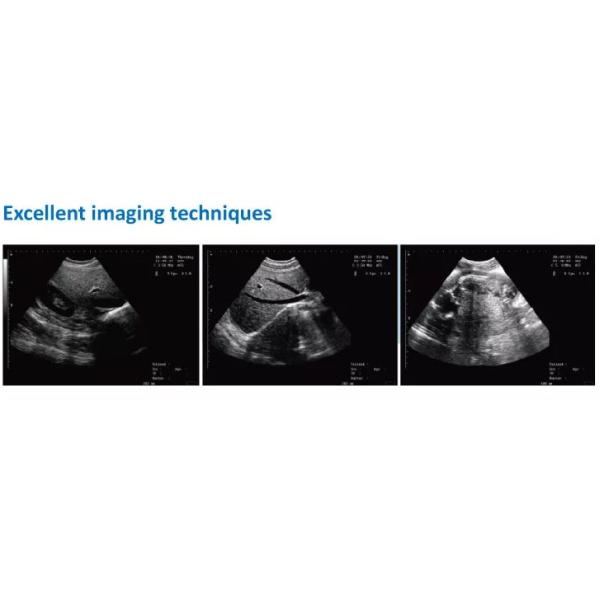 40mm Canine Ultrasound Machine Vaginal Probe Veterinary Medical Supplies Laptop Digital