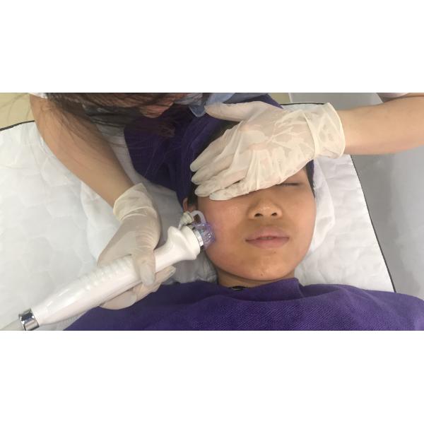 máquina de la elevación de cara del retiro de la cicatriz 5Mhz Microneedle RF