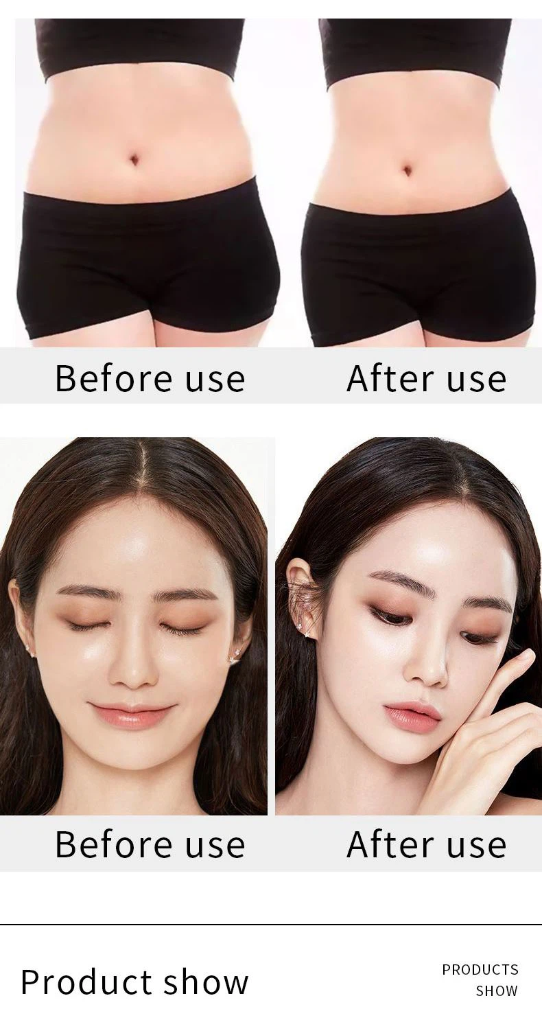 RF Beauty Equipment Lipo Laser Slimming Machine Body Shaping