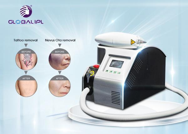 A máquina da remoção da tatuagem do laser do salão de beleza, Q comutou o laser do Nd Yag para a pigmentação