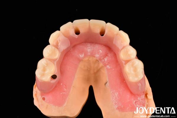 Dental Treatment High Elasticity Acrylic False Teeth Finish For Tooth Arrangement