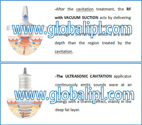 Ultrasonic Vertical Cavitation Slimming Machine For Skin Life / Body Shaping