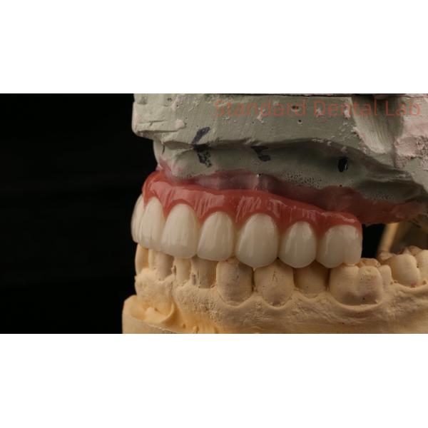 Hybrid Titanium Screw Retained Dental Implant Crown All On 4 Dental Implant Zirconia Bridge