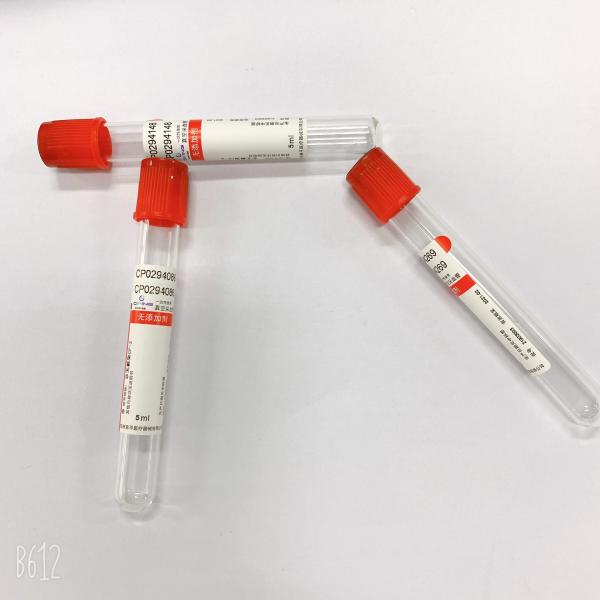 Do vácuo do sangue da coleção do tubo anticoagulação lisa consumível não