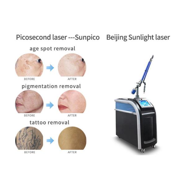 High - Tech Picosure Tattoo Removal Machine 755 Nm Handpiece For Skin Lifting