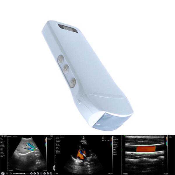 DICOM Medical Hospital Equipments 128 Element Portable Wifi Wireless Ultrasound Scanner