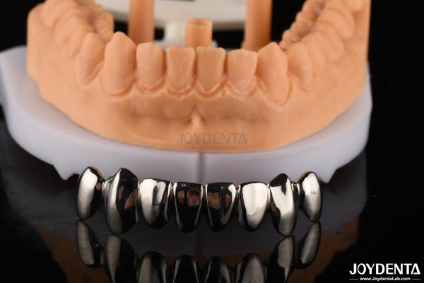 Dental Abrasive Resistant Crown Full Metal , Metallic FMC For Oral Rehabilitation