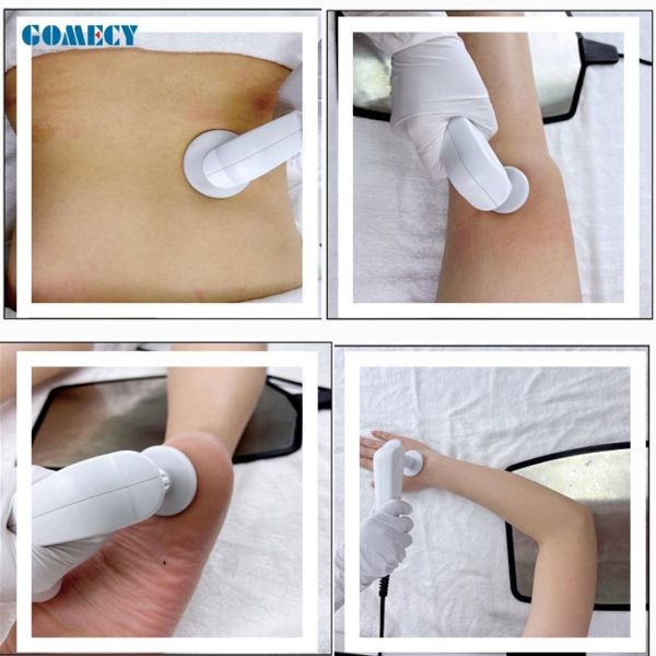 Tecar RF Instrument Radio Frequency Body Firm Skin Shape Machine Resisitive Capacitive