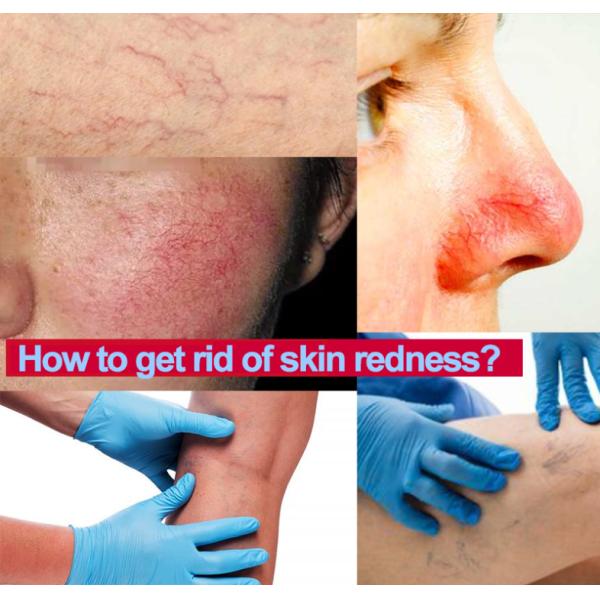 980 нм лазерная липосакционная машина для похудения