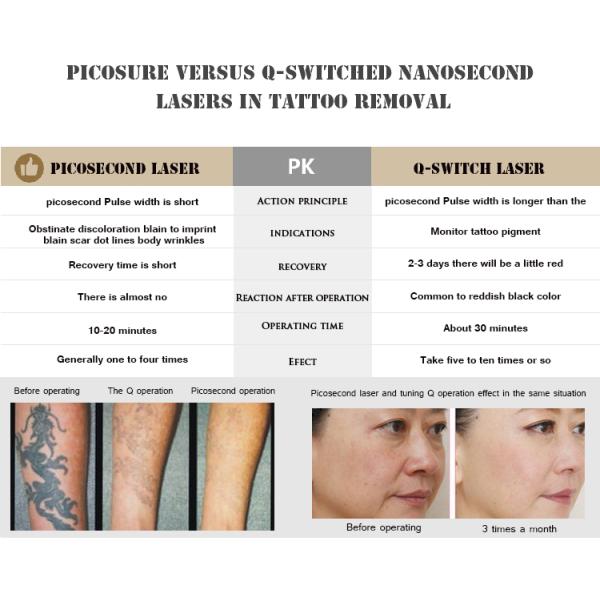 3000W big power 3 waves 532nm 1064nm 755nm 1320nm Pico Second Laser Tattoo Removal skin whitening with Quality Beam