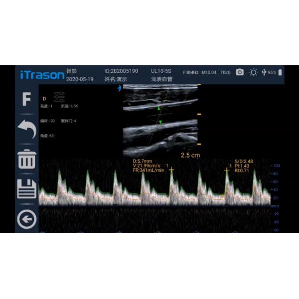PICC 12MHz Hand Held Wifi Ultrasound Scanner 128 Element Probe