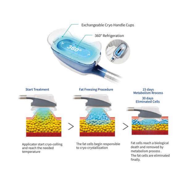 360° Criolipólisis congelación de grasa CoolSculpting cuerpo adelgazamiento máquina de pérdida de peso