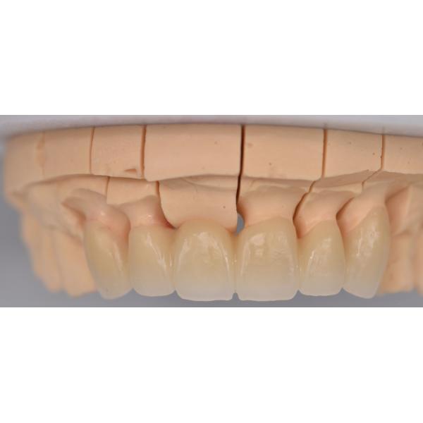 A2 Wieland High Translucent Dental Zirconia Multilayer 98×22mm Low Radioactive