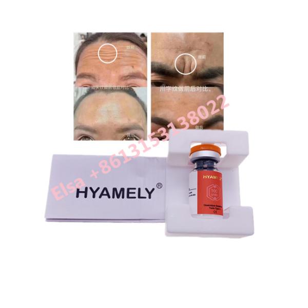 Toxina Botulinum de Hyamely Botox para datilografar um cosmético coreano de Botox 100u
