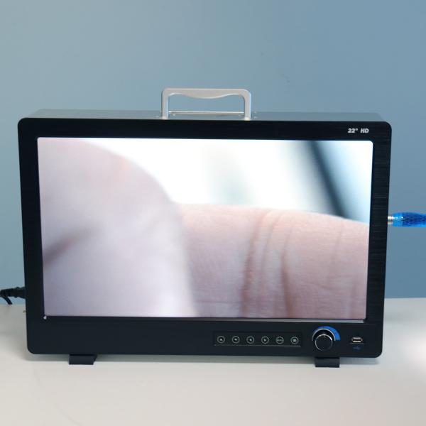 Portable Full HD Endoscope Camera For ENT Laparoscopy Hysteroscopy Cystoscopy Surgery Equipment
