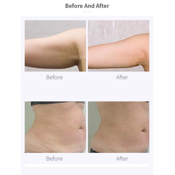 Touch Screen Vacuum Slimming Machine , 40k Ultrasonic Cavitation Machine