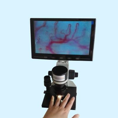 Microscópio/prego profissionais do Microcirculation do Nailfold que verifica microscópios