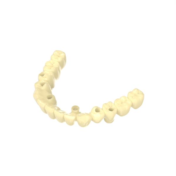 Biocompatible Material Photosensitive Resin 3d Printing For Temporary Crown And Bridge