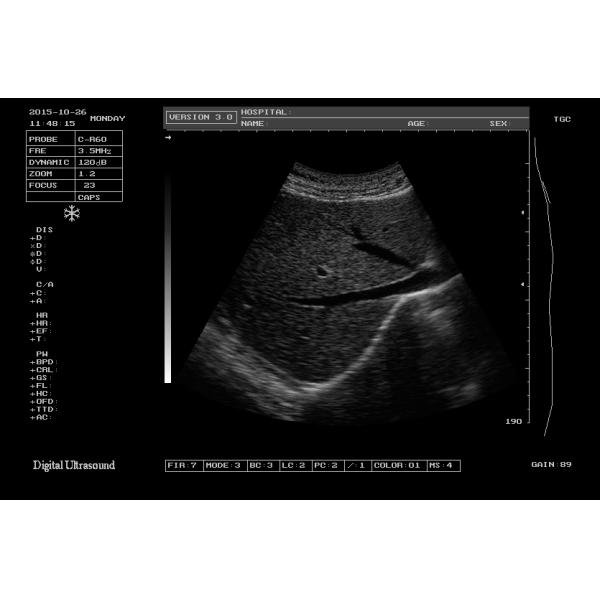 Notebook Surgical Device Scanner Hospital Medical Equipment Portable Ultrasound