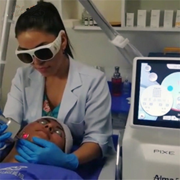 машина лазера СО2 635nm для обработки 110V-250V пор кожи большой