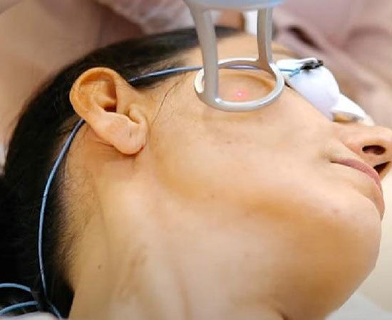 1927nm Fractional Thulium Laser Skin Rejuvenation Laser Machine 8W 15W 20W 30W