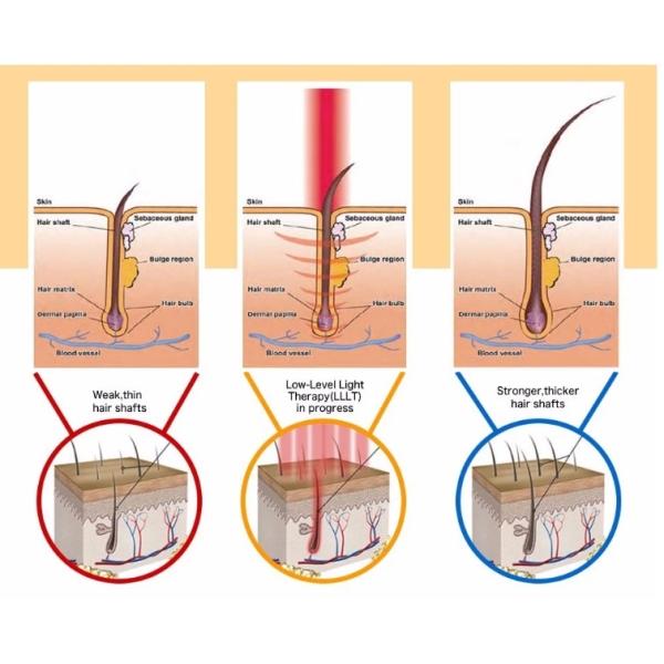 8 pouces de bio d'énergie ultra d'impulsion de laser de cheveux machine de croissance