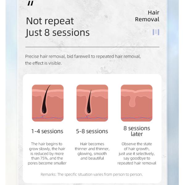 Переносное 808nm диодное лазерное удаление волос на теле Лазерный диодный эпилятор