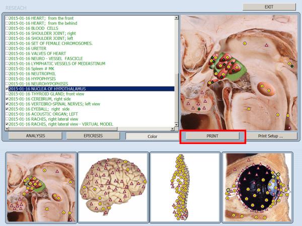 Automatic NLS Vector Bioresonance Health Diagnostic and Test Machine For Villas And Offices