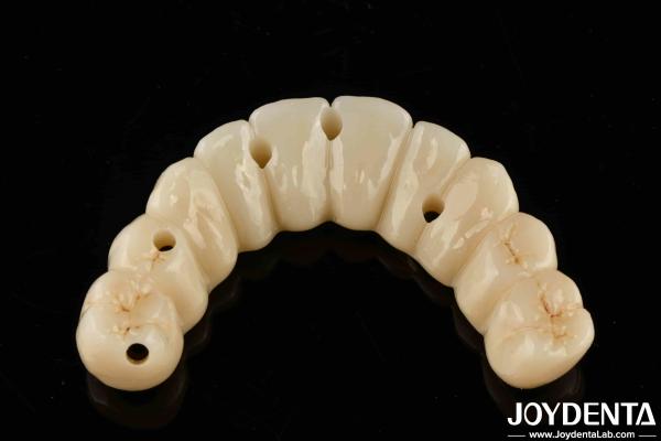 Prothèses dentaires sur mesure en zirconium hybride de pont de précision