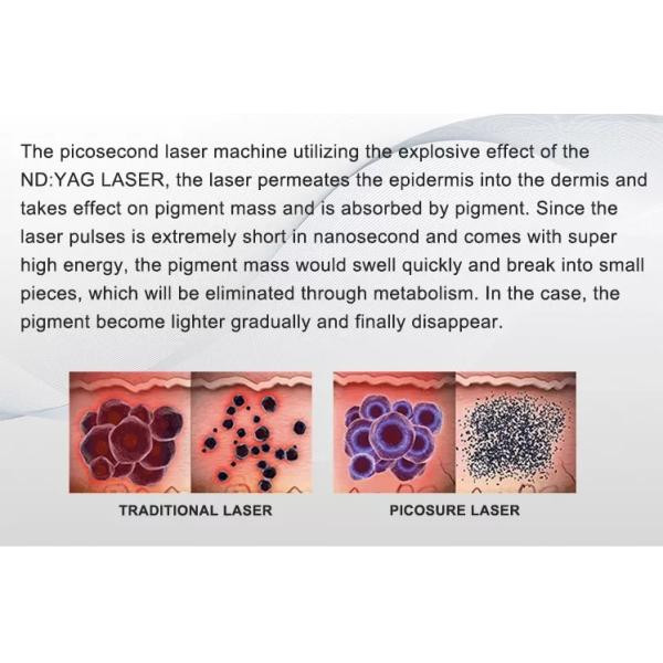 Portable Pico Laser Skin Spot Removal Machine Nd Yag Laser Tattoo Removal Machine Remove Lip Line Shrinks Pores