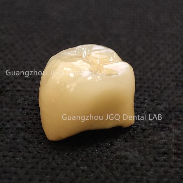 Porcelain Metal Crowns Fixed Denture Restorations Metal Pfm Custom China Dental Lab