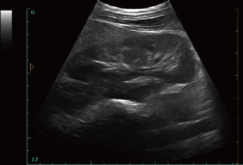 Блок развертки ультразвука ноутбука ультразвука СИД 12 дюймов диагностический медицинский с одним зондом подключает программное обеспечение ветеринара доступное