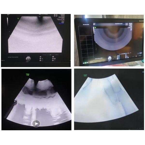 Reparação GE Voluson E10 RFM423 KTZ304074 5729200 KTZ304073 Imagem ultra-som ausente