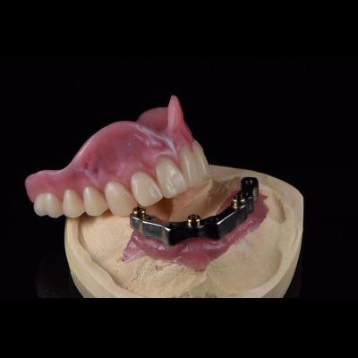 CAM Milled Titanium Bar Dental Implant Hybrid Prosthesis Dentures