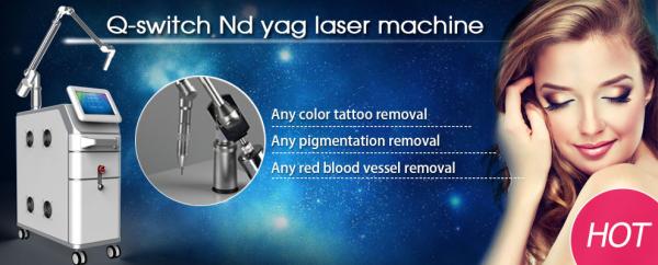 looking for distributor q-switch nd yag laser tattoo removal/nd:yag q-switch laser