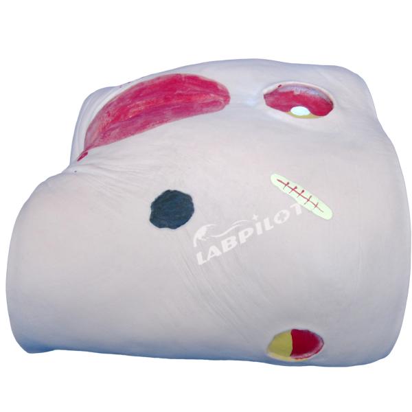 Human Model Decubitus Ulcer Care Training Simulator for Categories in Medical Science