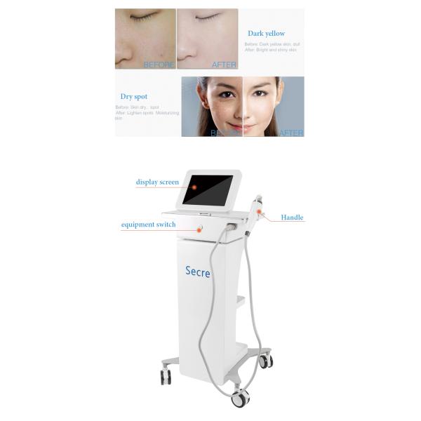 Переносное вакуумное утягивание кожи микроигла Красочная машина по уходу за кожей Золото Радиочастота Rf Микроигла