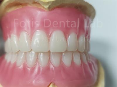 Durable Natural Color Full Acrylic Denture Odorless Customization