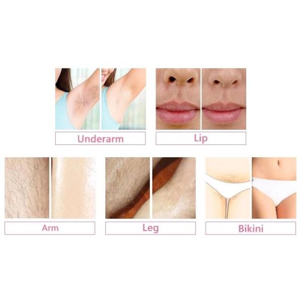 система удаления волос лазера салона 755нм/808нм/1064нм двойная ТЕХНИЧЕСКАЯ ИПЛ