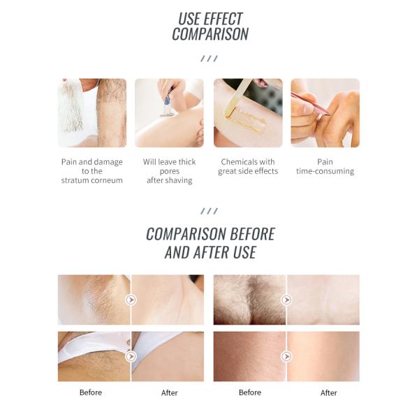 Máquina láser portátil para la depilación y el rejuvenecimiento de la piel