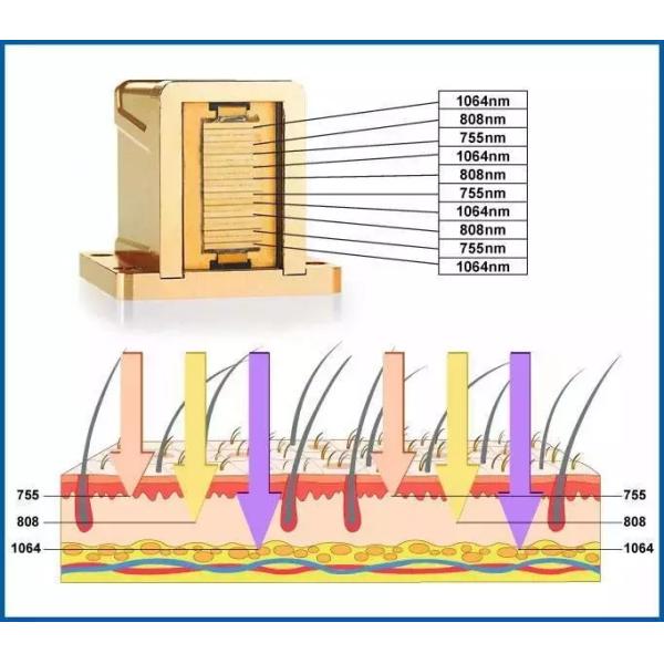 Single Handle 3 Wavelength 808 755 1064nm 1200W Diode Laser Hair Removal Y9 Pro