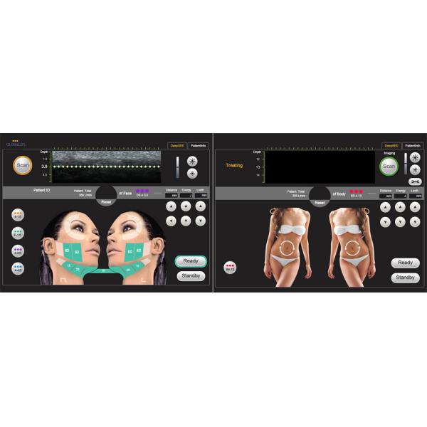 Skin Rejuvenation HIFU Beauty Machine High Intensity Focused Ultrasound