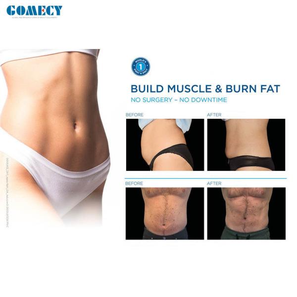 Портативная машина 100Hz скульптуры тела Hiemt Emslim с 4 ручками