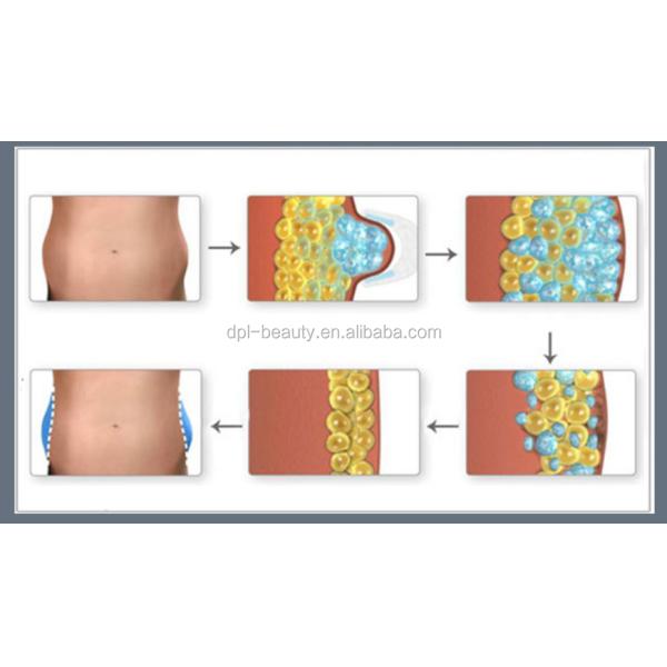 DM-55-1 Skin Tightening 360 Cryolipolysis Slimming Machine 50KHZ Anti Cellulite