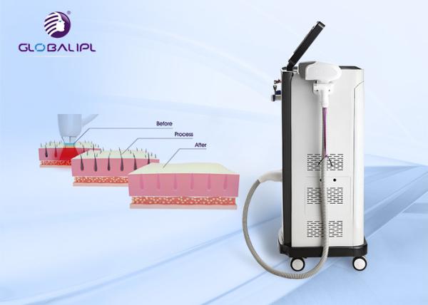 Germany 808nm Diode Laser 13x13mm Microchannel Hiar Removal Machine