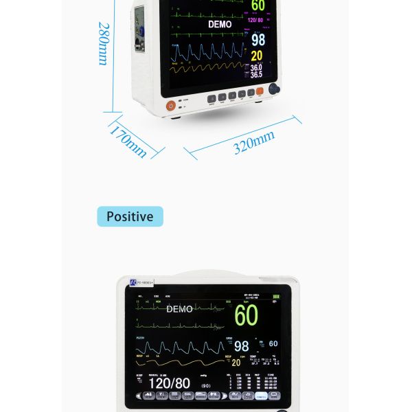 Monitor de paciente multiparamétrico con fuente de alimentación eléctrica, batería incorporada y alarma inteligente de tres niveles