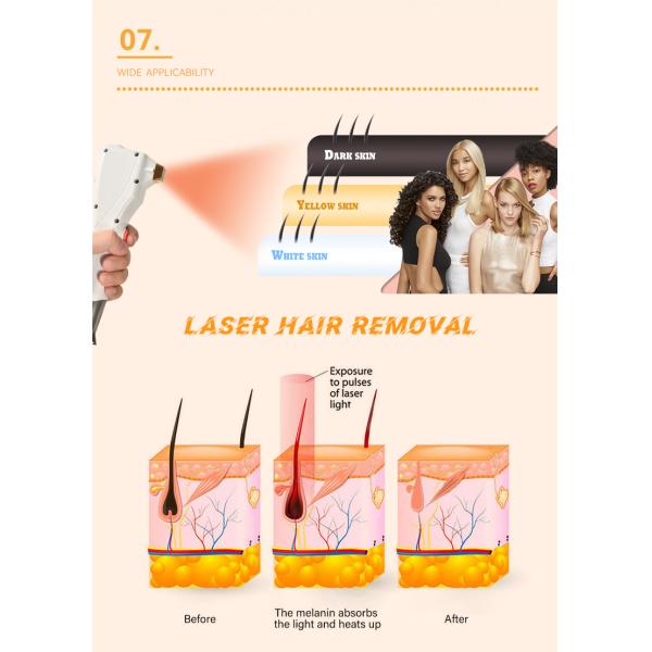 Beauty Salon Equipment Fiber Diode Laser Hair Removal Machine with Germany Laser Bar