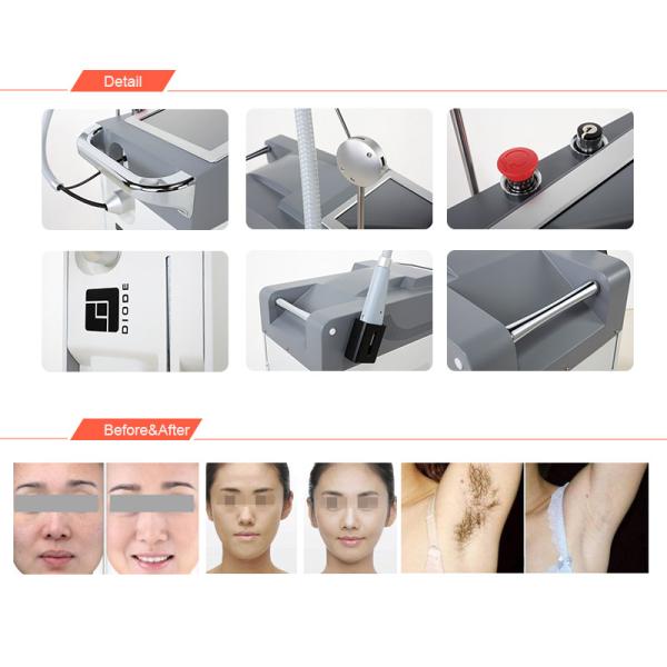 Hair Removal Long Pulsed Nd Yag Laser Stationary Style With Ce Approved