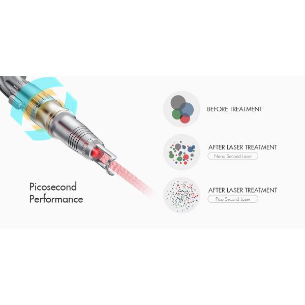 Переключенное q 1064nm удаление татуировки удаления Chloasma Nd Yag извлекает машину лазера пикосекунды пятен