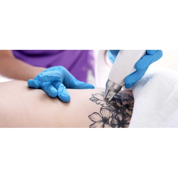 Air Cooling ND YAG Laser Tattoo Removal Machine 750ps High Peak Power